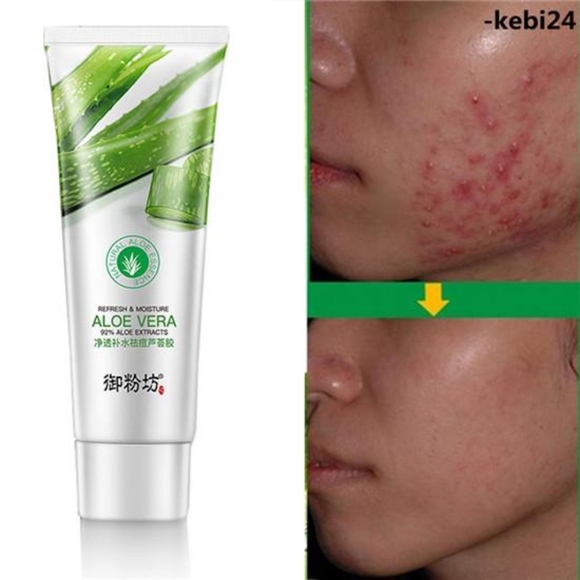 Aloe Vera  Gel Repair Acne - Picture 1 of 4